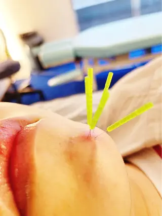 小顔美容鍼専門サロン 渋谷YZのエステ・リラクイメージ