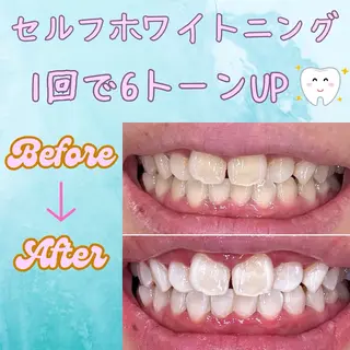 メンズ soerute所属・オーラルケアサロン soeruteのその他イメージ