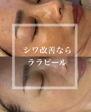 WHITE AQUA 北千住店のエステ・リラクイメージ