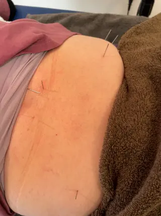 【鍼灸サロン にった】所属・はりきゅう整体 新田鍼灸院のエステ・リラクイメージ