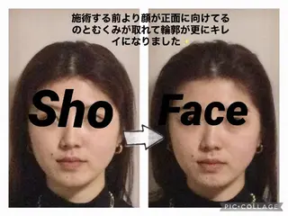 小顔矯正Sho FaceDesignのエステ・リラクイメージ