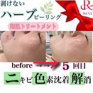 laluna saki...のその他イメージ