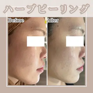 メンズ Amaryllis 🌹松本のエステ・リラクイメージ