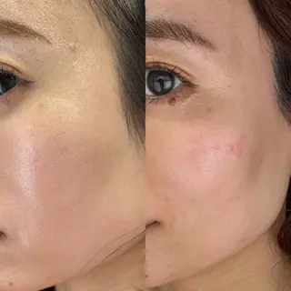 ［　］Shiro Meiのエステ・リラクイメージ