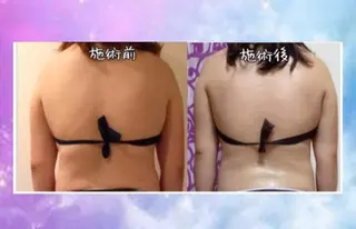 ショート カラー パーマ ヘアアレンジ メンズ キッズ ネイル マツエク・マツパ 強圧オールハンド痩身&黄土よもぎ蒸しプライベートサロンClematis池袋所属・強圧オールハンド痩身 片野のエステ・リラクイメージ