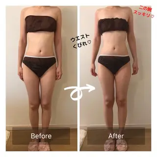 エステティックサロンPartagé【パルタージュ】所属・小尻・太もも痩せる パルタージュのエステ・リラクイメージ