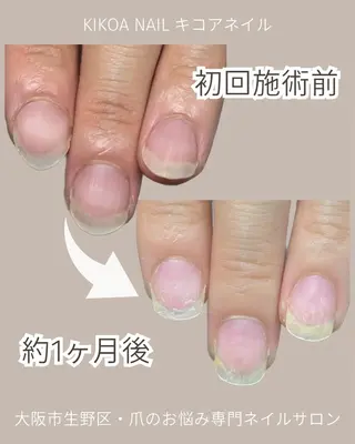ネイル KIKOA NAIL キコアネイルのネイルデザイン