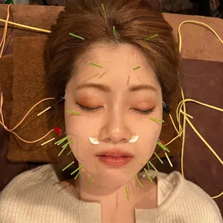 メンズ 美容鍼灸サロン LOMIHARIのエステ・リラクイメージ