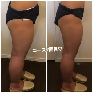 FLEUR大阪・美容 整体・痩身・小顔のエステ・リラクイメージ