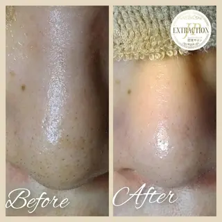 エステサロン Lazulisea所属・川口 春奈のエステ・リラクイメージ