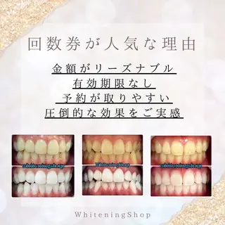 ホワイトニング ショップ川越店のエステ・リラクイメージ