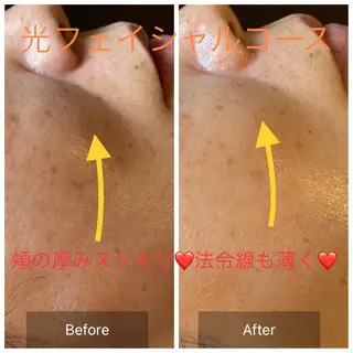 Mandarin Orange所属・毛穴から始める肌メン テマンダリンオレンジのエステ・リラクイメージ