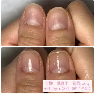 ネイル AKT NAIL所属・AKT Beauty エステヘッドスパのエステ・リラクイメージ