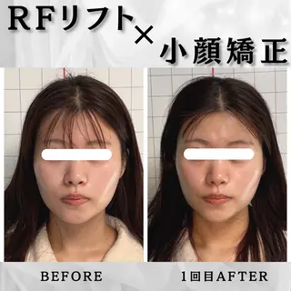 小顔矯正専門店 ❤️池田 桃花のエステ・リラクイメージ