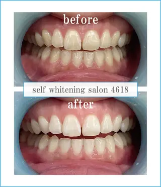 self whitening salon 4618所属・ホワイトニングサロン 4618のその他イメージ