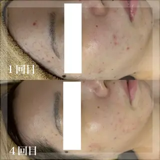 WHITE AQUA 北千住店のエステ・リラクイメージ