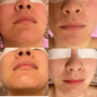 Einami 美肌痩身サロンのエステ・リラクイメージ