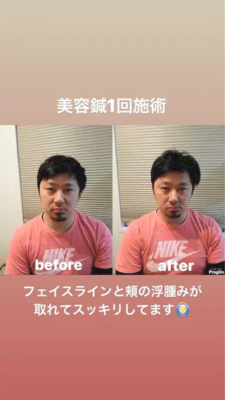 鍼灸整骨院Refine所属・鍼灸 Refineのその他イメージ