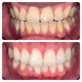 ネイル アイブロウ マツエク・マツパ メンズ パーマ ロング カラー ライトビューティー 銀座本店のエステ・リラクイメージ