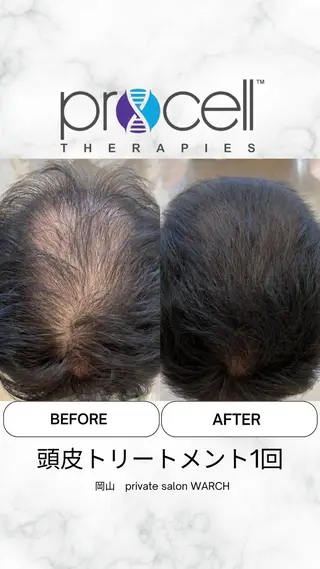 WARCH Marieのその他イメージ