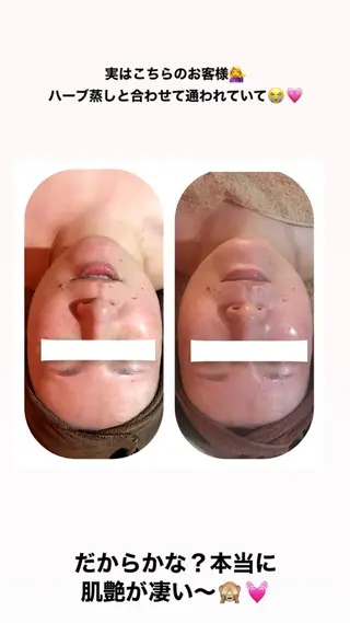 【足圧】鬼👹リンパ 身体整うサロンのエステ・リラクイメージ