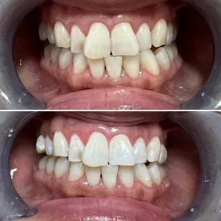 セルフホワイトニング Shineeのエステ・リラクイメージ