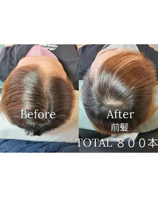 歯科提携セルフダック 宇都宮駒生店のエステ・リラクイメージ