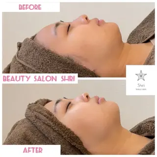 salon Lewis Addict所属・ルイスアディクト 名駅店のエステ・リラクイメージ