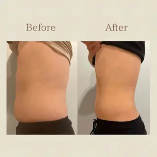 お腹痩せエステ Flat BELLY 恵比寿所属・【腸もみ/脂肪冷却】 お腹エステ/恵比寿のエステ・リラクイメージ