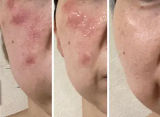 private salon  Dea_maris シュガーリング＆パーソナルボディケア所属・シミ改善・韓国肌管理 ボディメイク痩身のその他イメージ