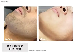 VIERU YURIのネイルデザイン