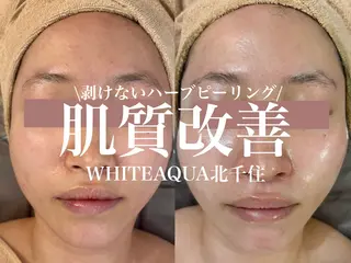 WHITE AQUA 北千住店のエステ・リラクイメージ