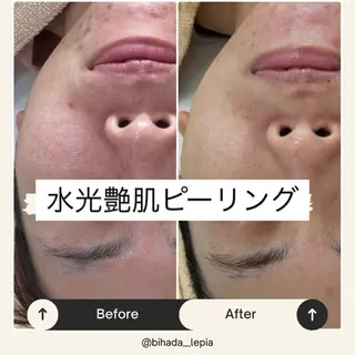 肌質管理専門店 Lé pia　AMIのエステ・リラクイメージ