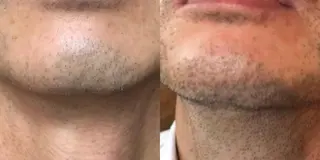 メンズ Ganesa Fusion Studio所属・井上 みあのエステ・リラクイメージ