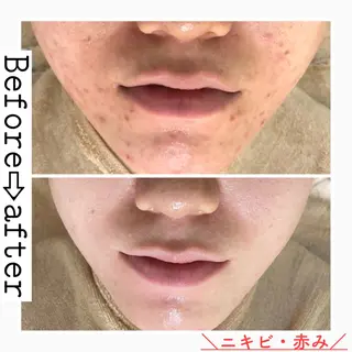 ロング カラー パーマ ヘアアレンジ メンズ キッズ ネイル マツエク・マツパ ニキビ&跡改善サロン オーナー光木のエステ・リラクイメージ