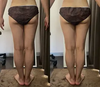 ハイパーナイフ専門店 Salon de COCO所属・Salon de COCOのエステ・リラクイメージ