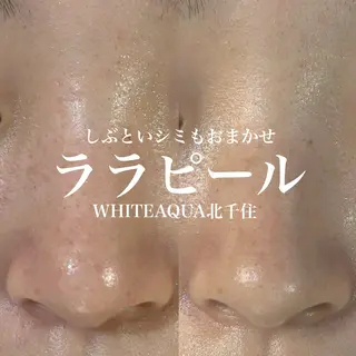 WHITE AQUA 北千住店のエステ・リラクイメージ