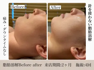 脱毛&フェイシャル 専門店muro.のエステ・リラクイメージ