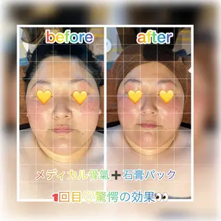 Tanpopo所属・メディカル骨氣サロン Tanpopoのエステ・リラクイメージ