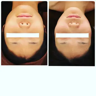 FLEUR大阪・美容 整体・痩身・小顔のエステ・リラクイメージ