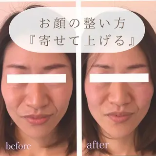 小顔×肌質改善サロン soin〔ソワン〕のエステ・リラクイメージ