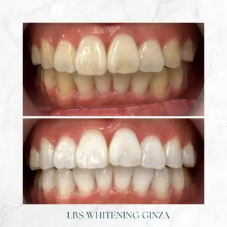 メンズ LBSホワイトニング 銀座店💎公式のその他イメージ