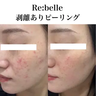 Lelala （リララ）所属・lelala 江坂店のエステ・リラクイメージ