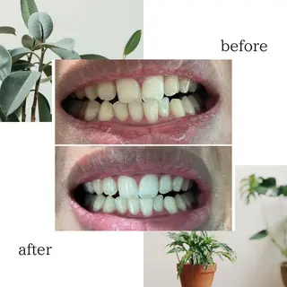 脱毛専門サロンELIXIR（ｴﾘｸｻｰ）所属・脱毛&ホワイトニング ELIXIR×ULTのエステ・リラクイメージ