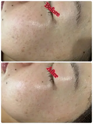 espoir エスポワールのネイルデザイン