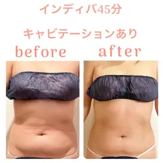 インディバサロン LILY  新宿御苑のエステ・リラクイメージ