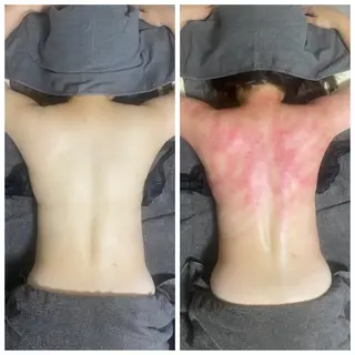 セルライトクラッシュ 腸もみ　bi♡eruのその他イメージ