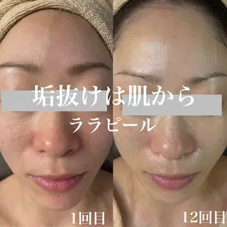 WHITE AQUA 北千住店のエステ・リラクイメージ