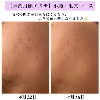 Bellesthe (ベルエステ)のエステ・リラクイメージ