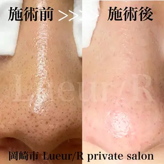 大久保 里奈のエステ・リラクイメージ